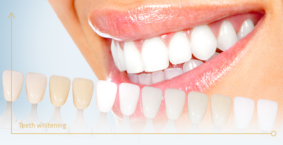 Effective Whitening Solutions Delivering Brighter Teeth Without Complex Dental Procedures